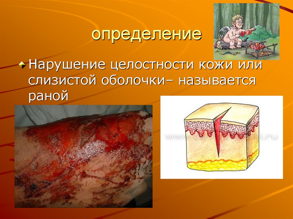 определение