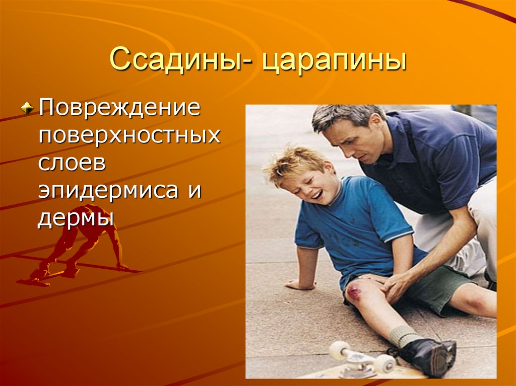 Ссадины- царапины