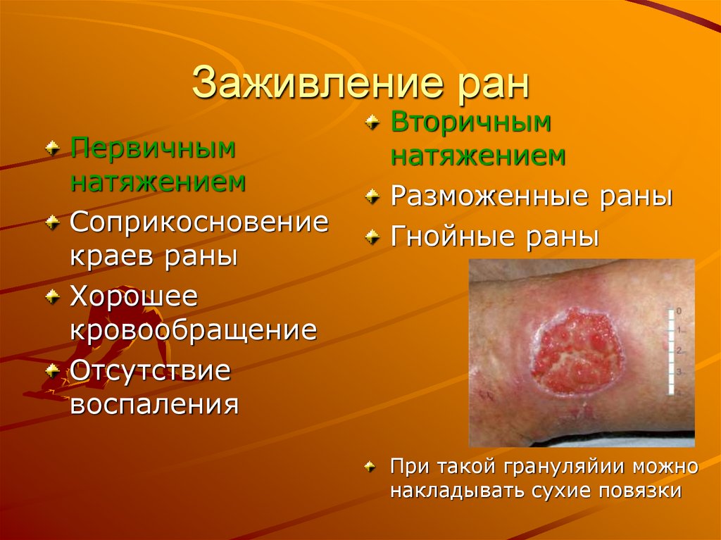 Заживление ран