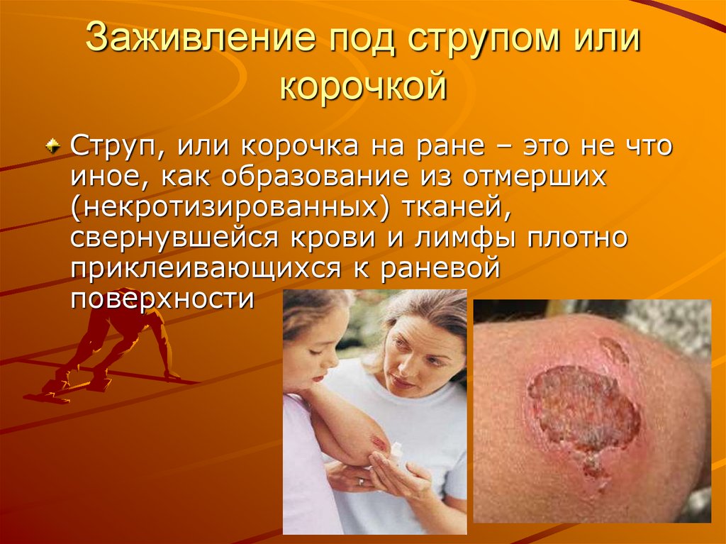 Заживление под струпом или корочкой