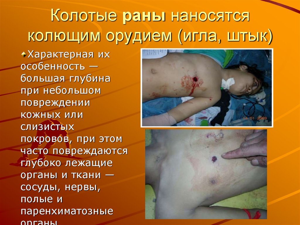 Колотые раны наносятся колющим орудием (игла, штык)