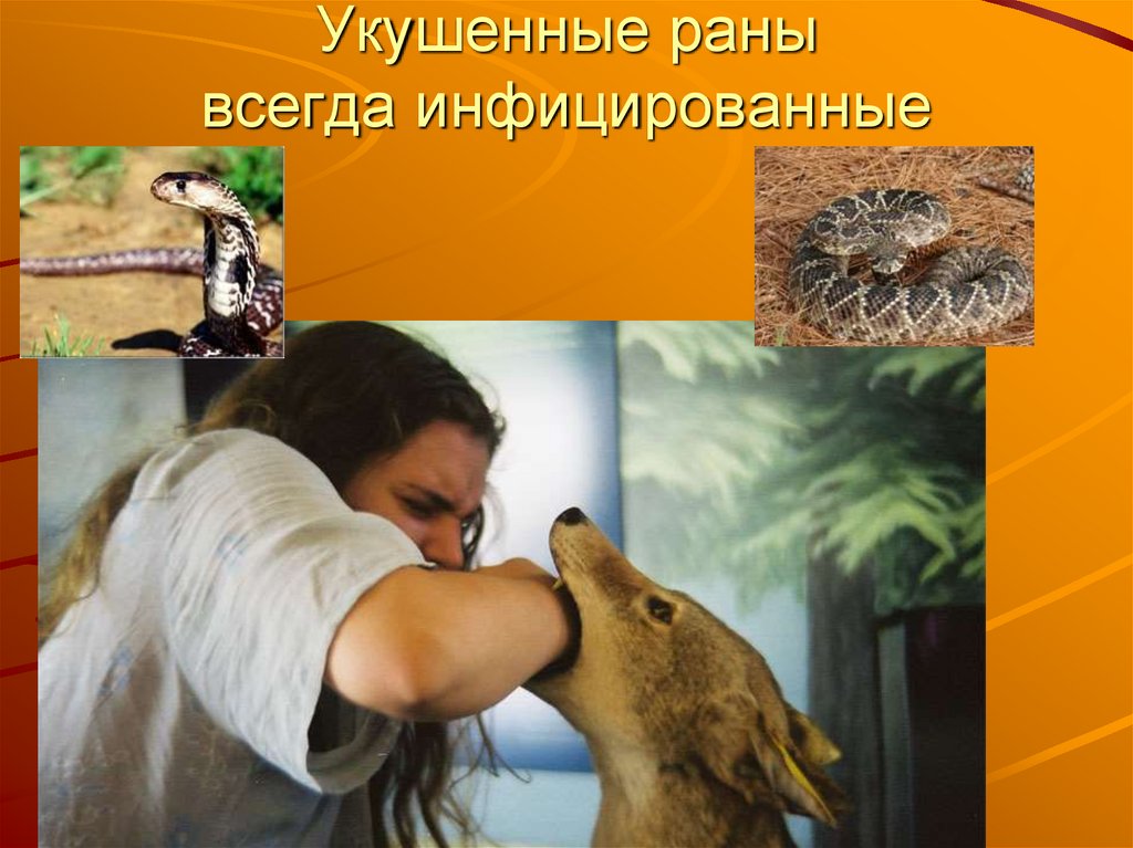 Укушенные раны всегда инфицированные