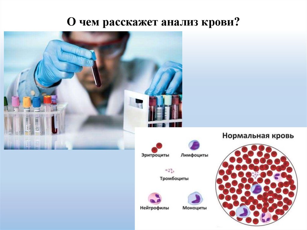 О чем расскажет анализ крови?