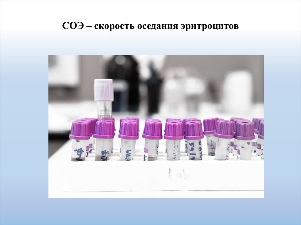 CОЭ – скорость оседания эритроцитов