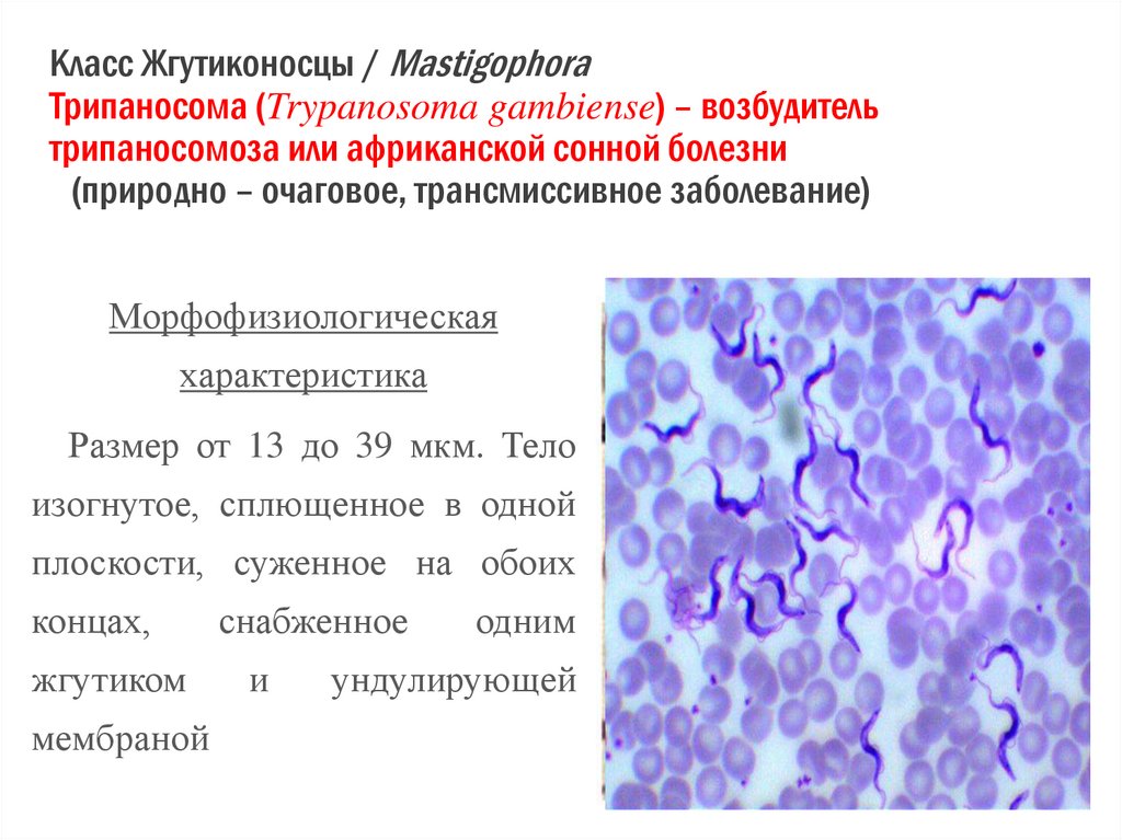 Класс Жгутиконосцы / Mastigophora Трипаносома (Trypanosoma gambiense) – возбудитель трипаносомоза или африканской сонной