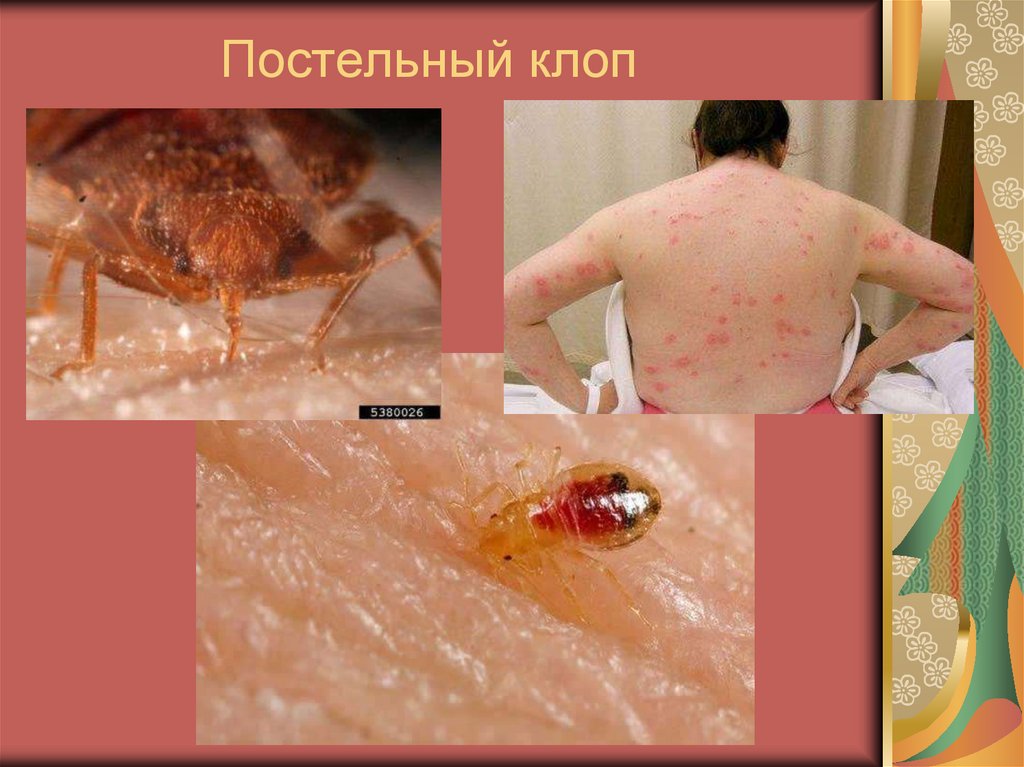 Постельный клоп