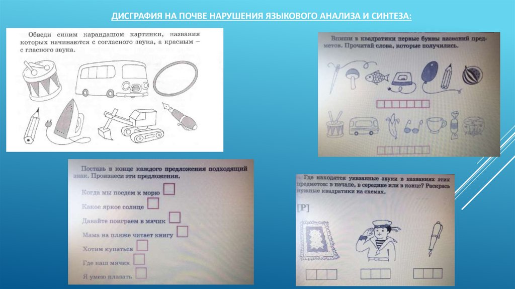 Дисграфия на почве нарушения языкового анализа и синтеза: