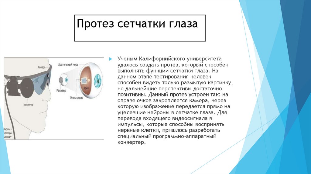 Протез сетчатки глаза