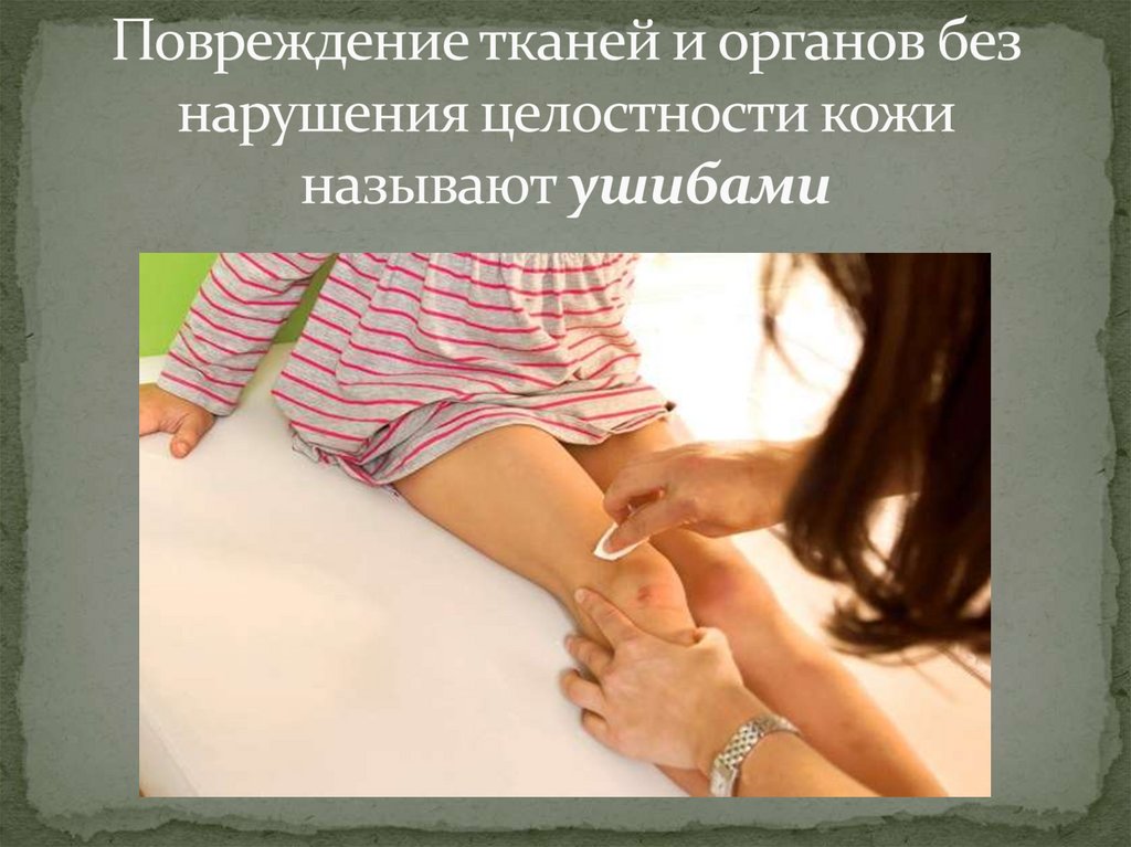 Повреждение тканей и органов без нарушения целостности кожи называют ушибами