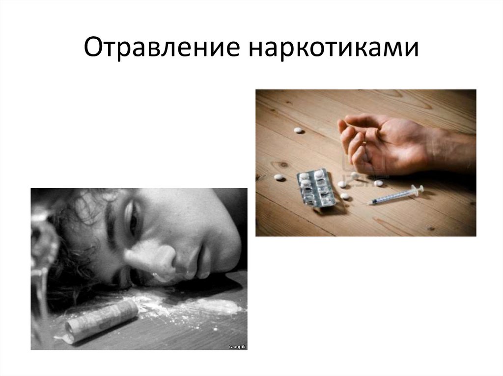 Отравление наркотиками