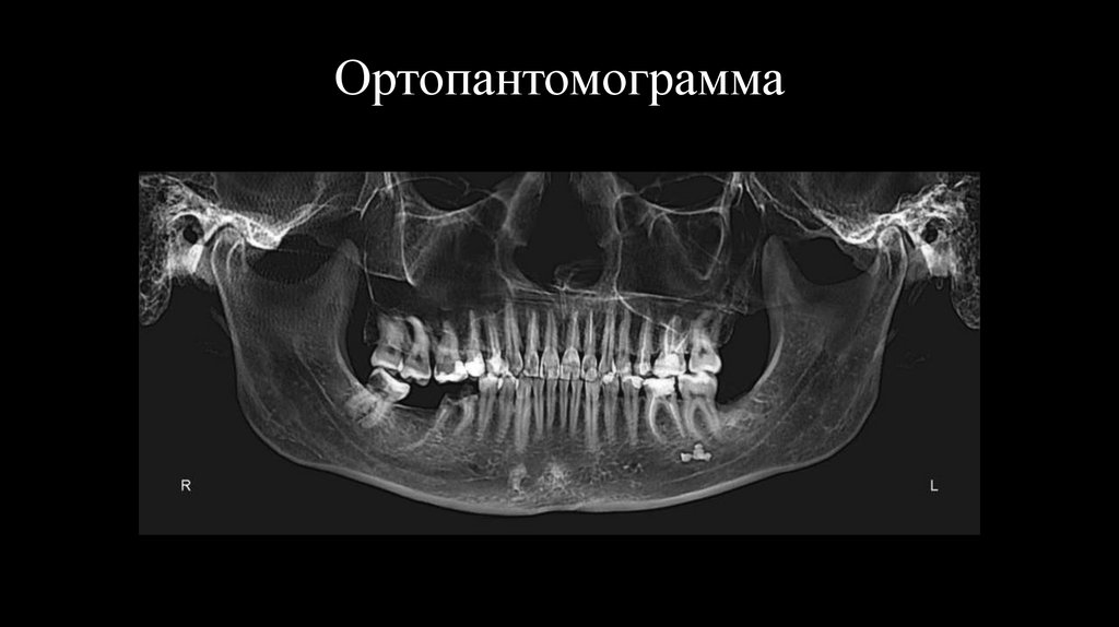 Ортопантомограмма