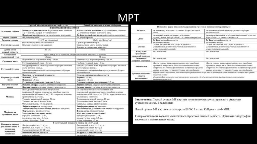 МРТ