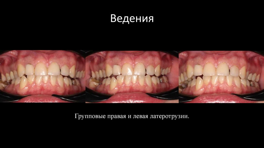 Ведения