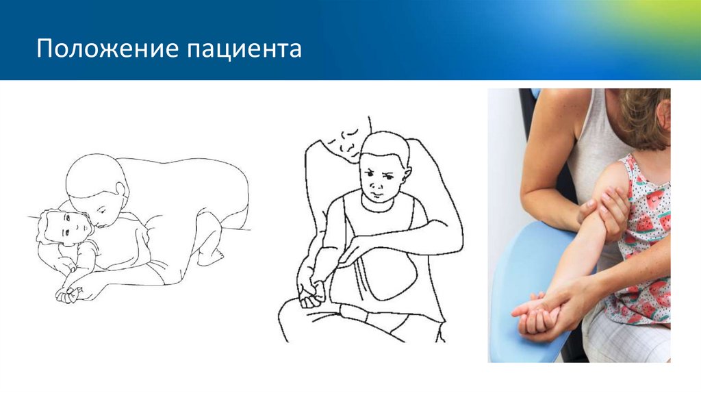 Положение пациента