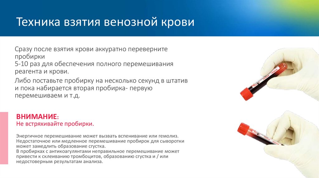 Техника взятия венозной крови