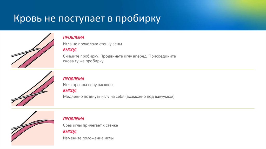 Кровь не поступает в пробирку