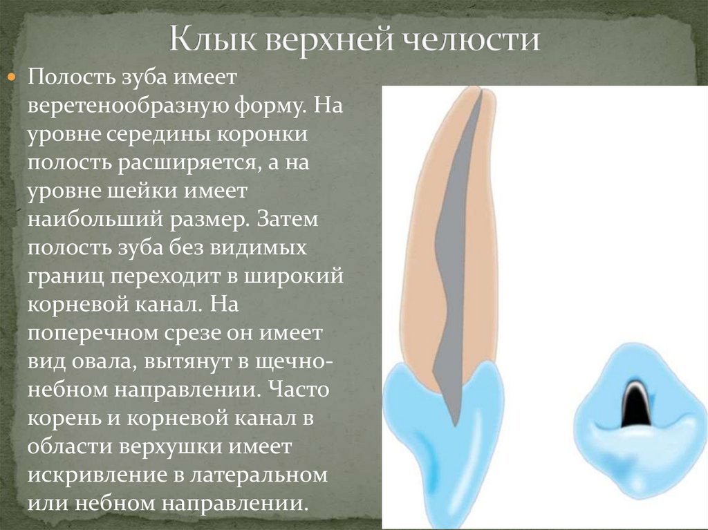 Клык верхней челюсти