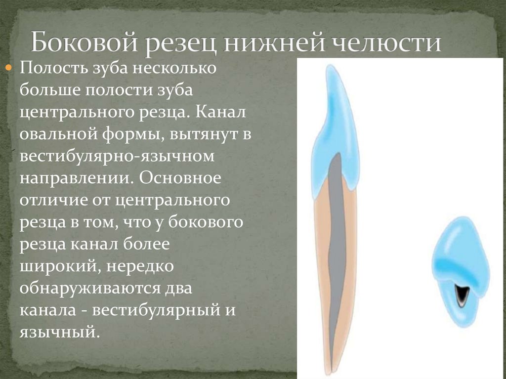 Боковой резец нижней челюсти