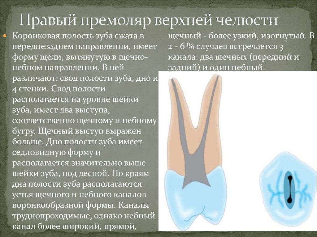 Правый премоляр верхней челюсти