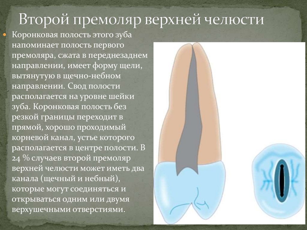 Второй премоляр верхней челюсти