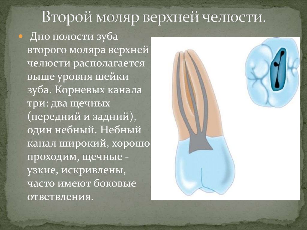 Второй моляр верхней челюсти.