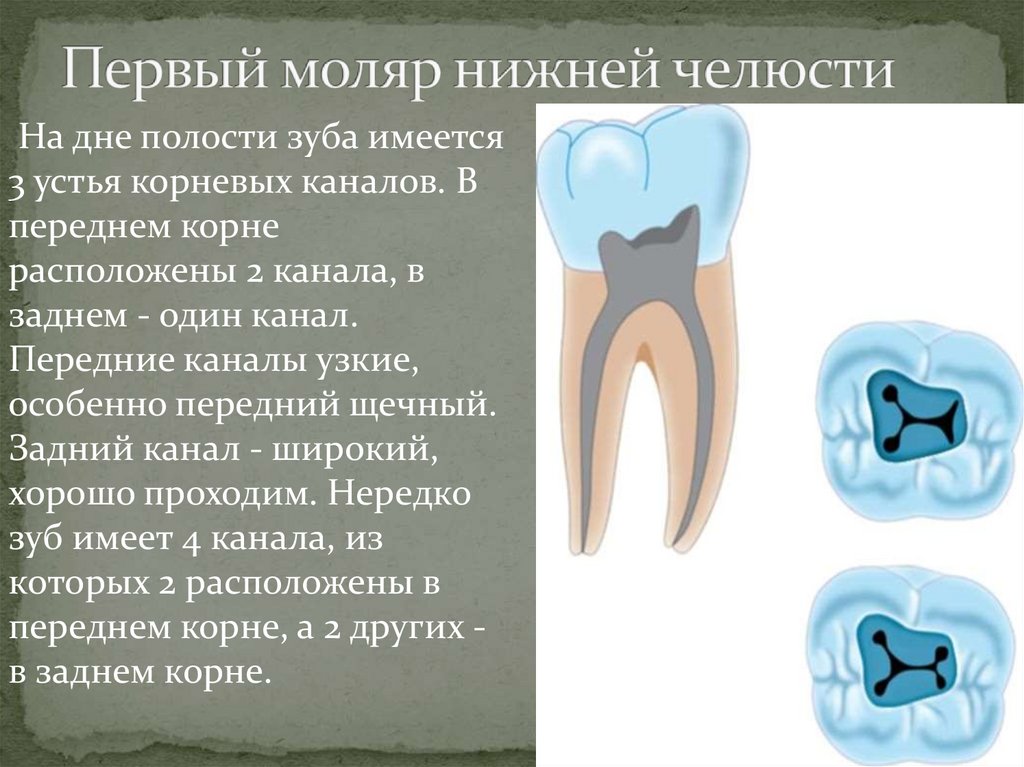 Первый моляр нижней челюсти