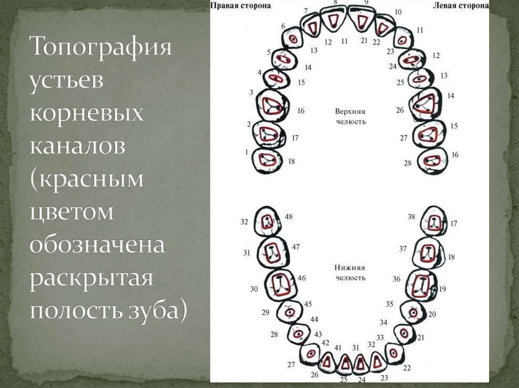 Топография устьев корневых каналов (красным цветом обозначена раскрытая полость зуба)