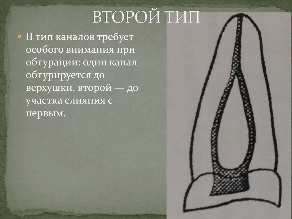 ВТОРОЙ ТИП