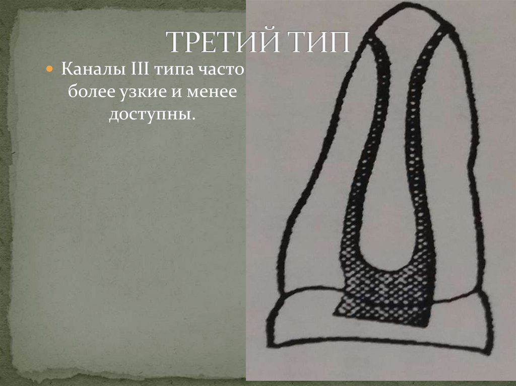 ТРЕТИЙ ТИП