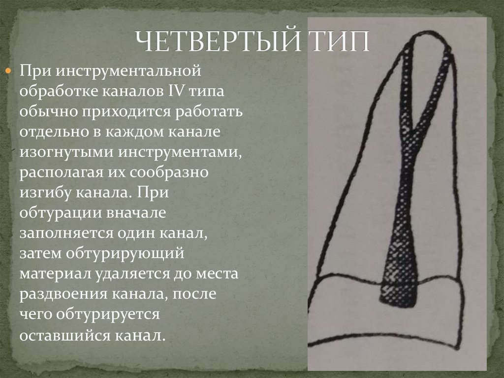 ЧЕТВЕРТЫЙ ТИП