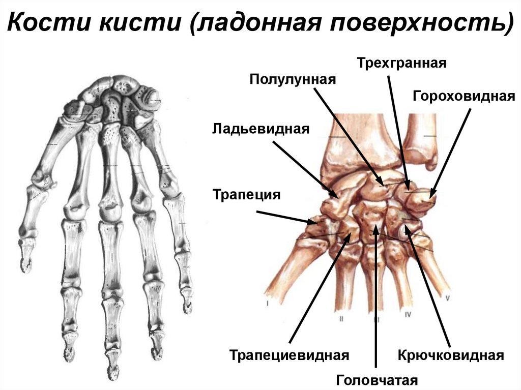 Кости кисти (ладонная поверхность)