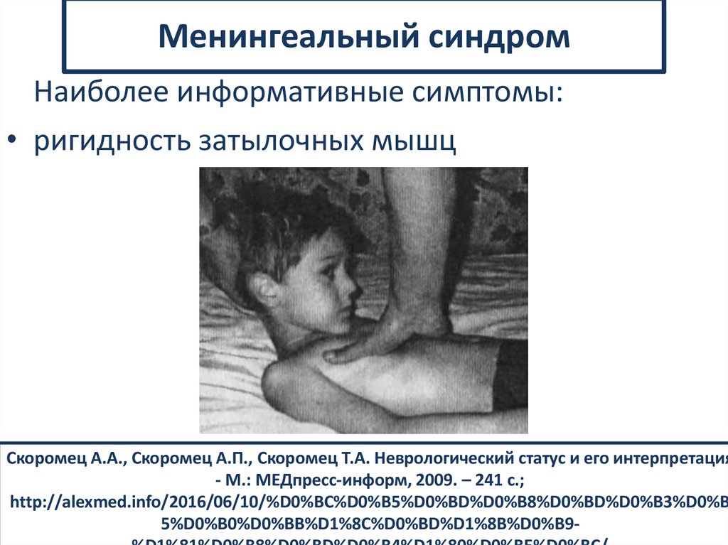 Менингеальный синдром