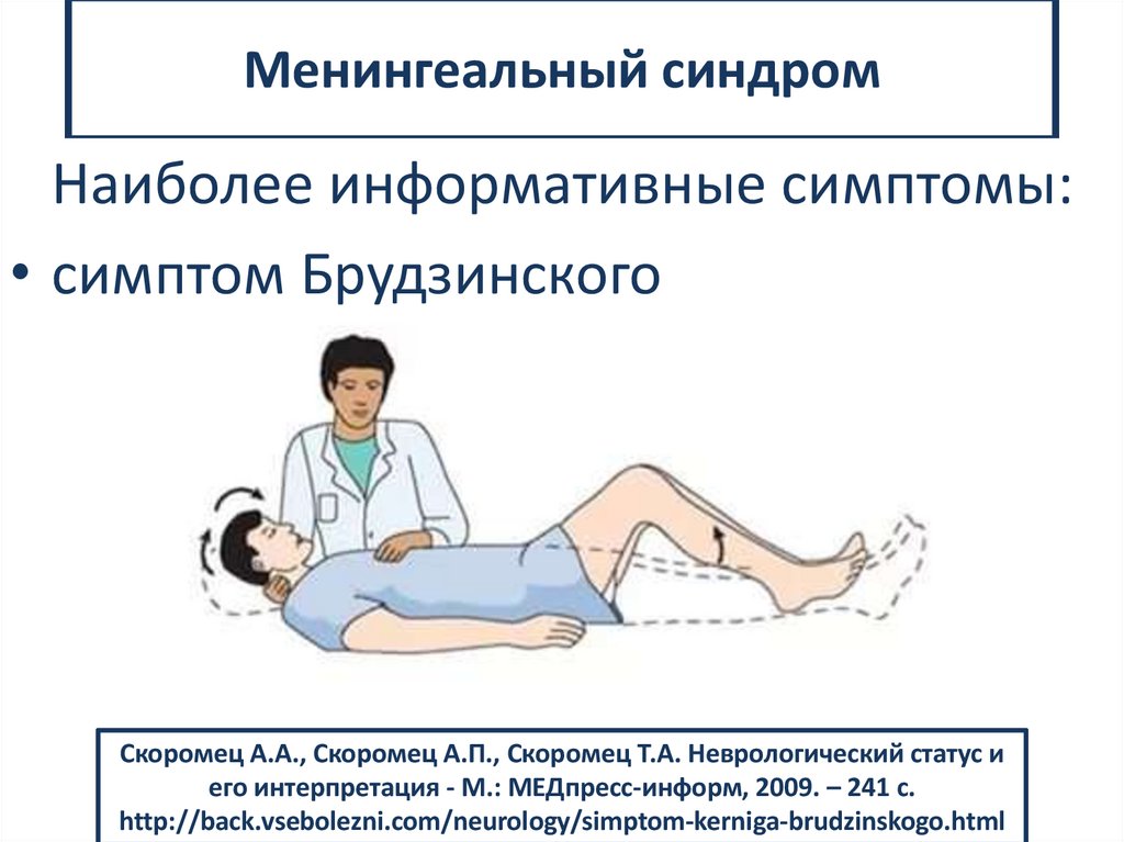 Менингеальный синдром