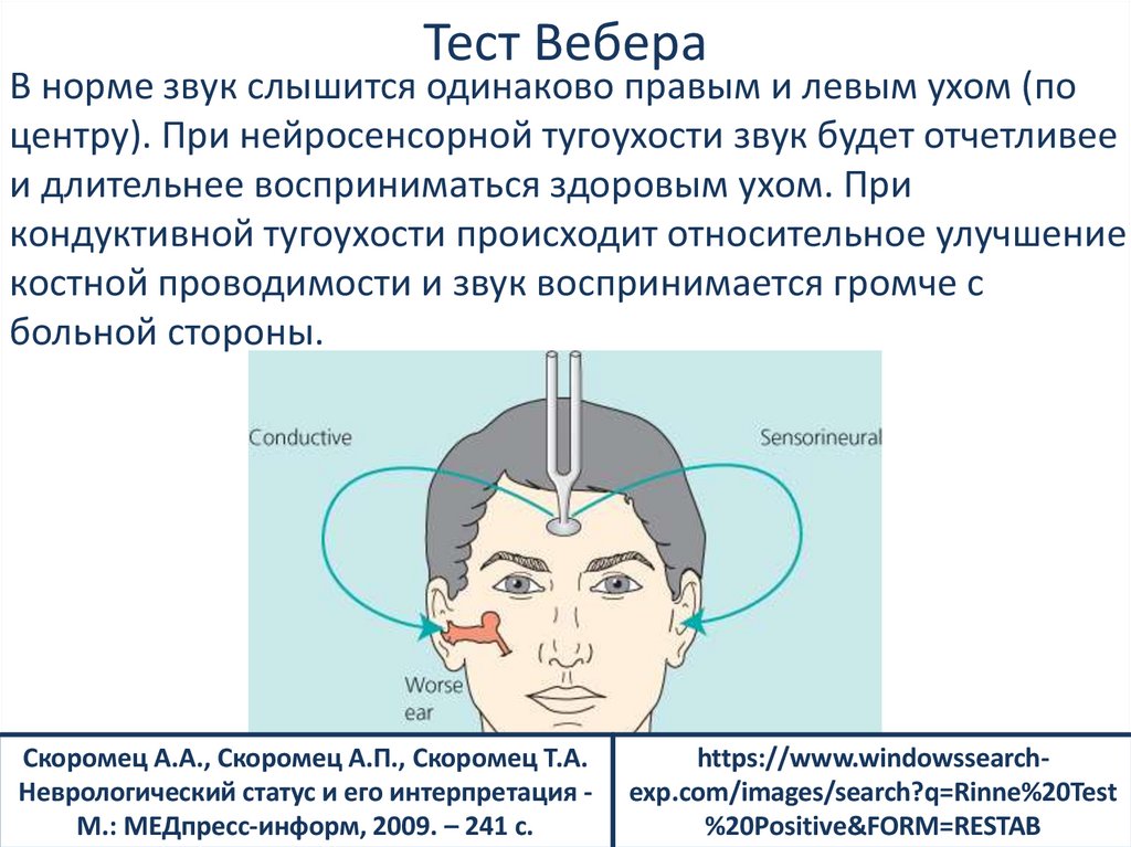 Тест Вебера