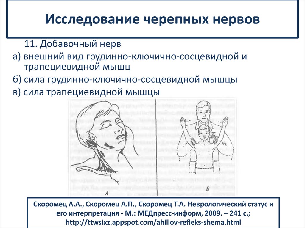 Исследование черепных нервов