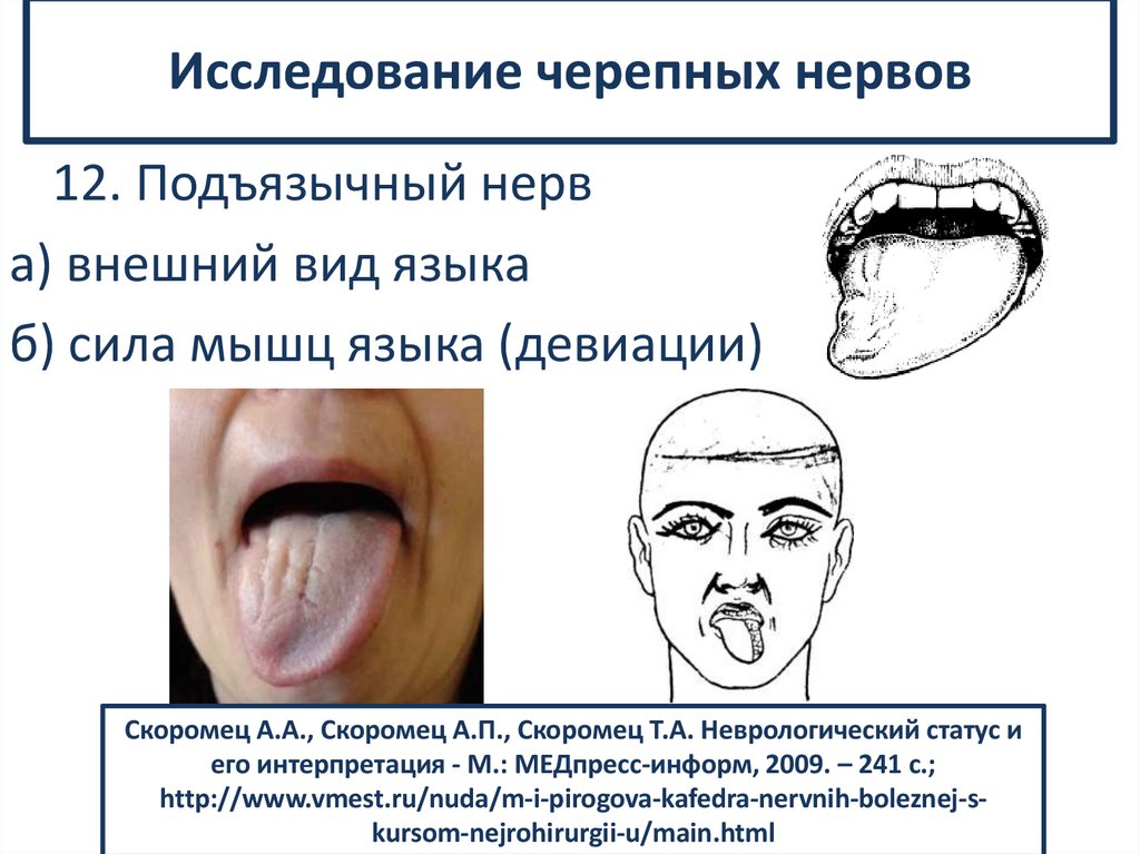 Исследование черепных нервов