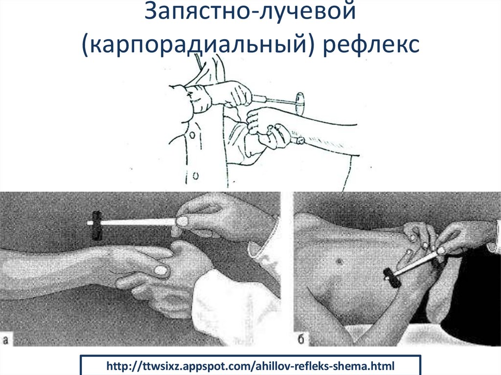 Запястно-лучевой (карпорадиальный) рефлекс
