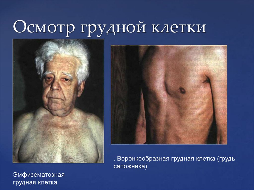 Осмотр грудной клетки