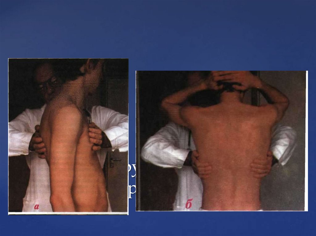 Пальпация грудной клетки- определение ригидности