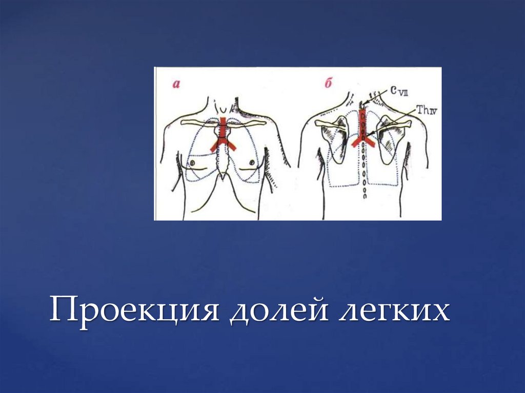Проекция долей легких