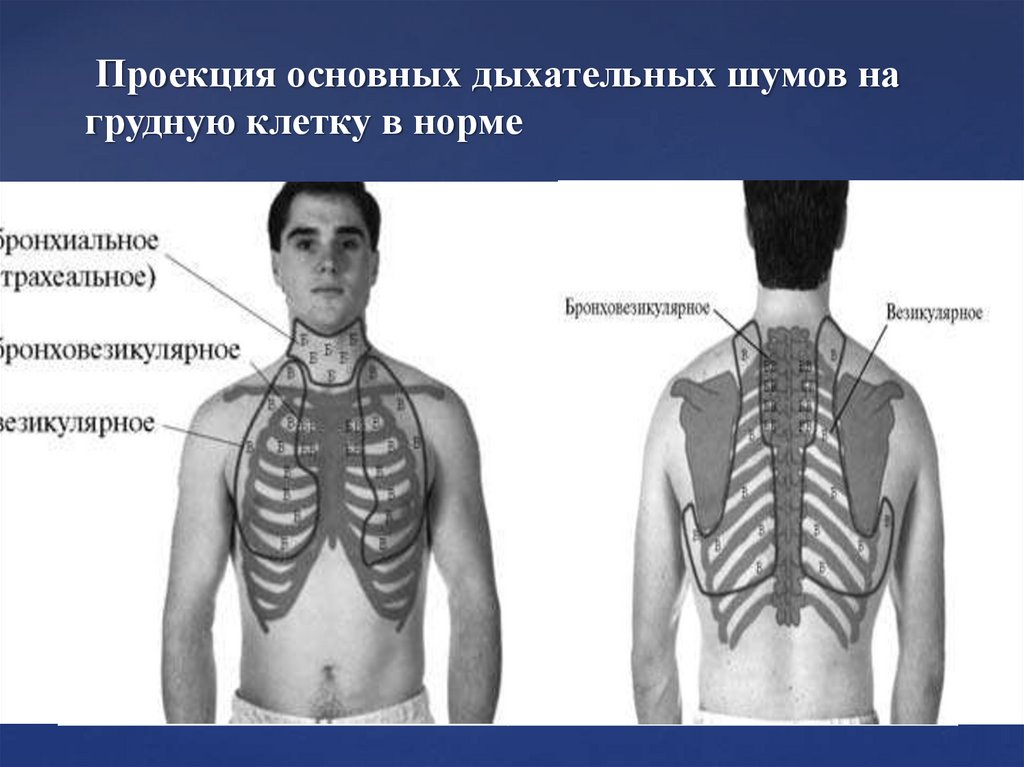 Проекция основных дыхательных шумов на грудную клетку в норме