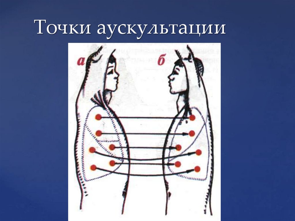 Точки аускультации