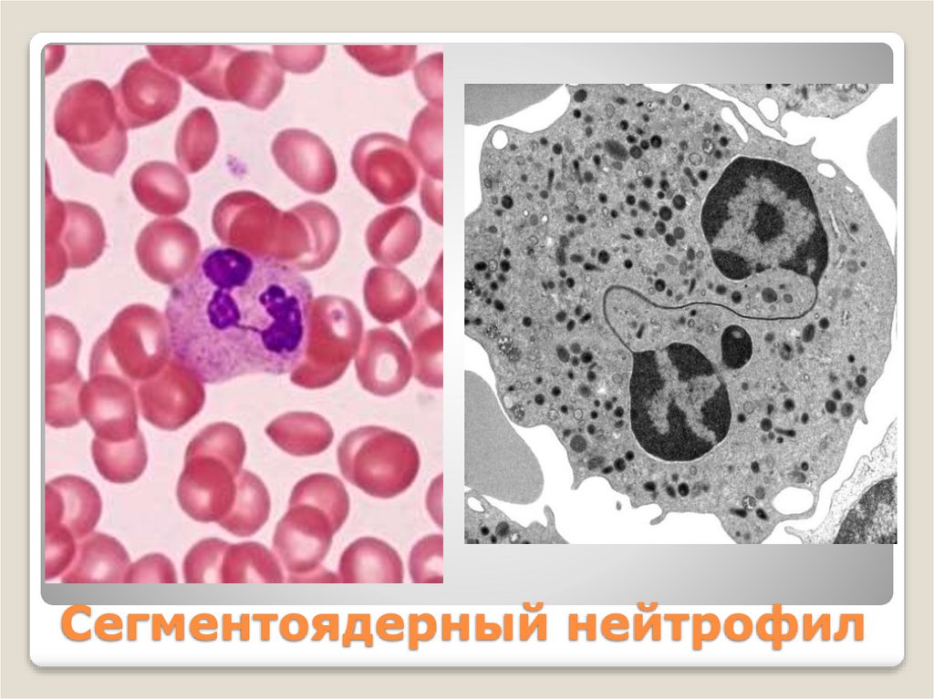 Сегментоядерный нейтрофил