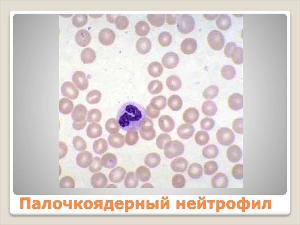 Палочкоядерный нейтрофил