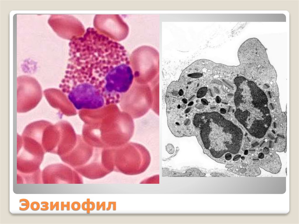 Эозинофил