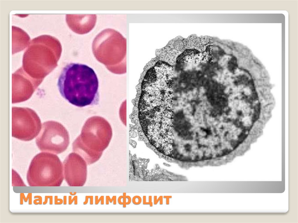 Малый лимфоцит