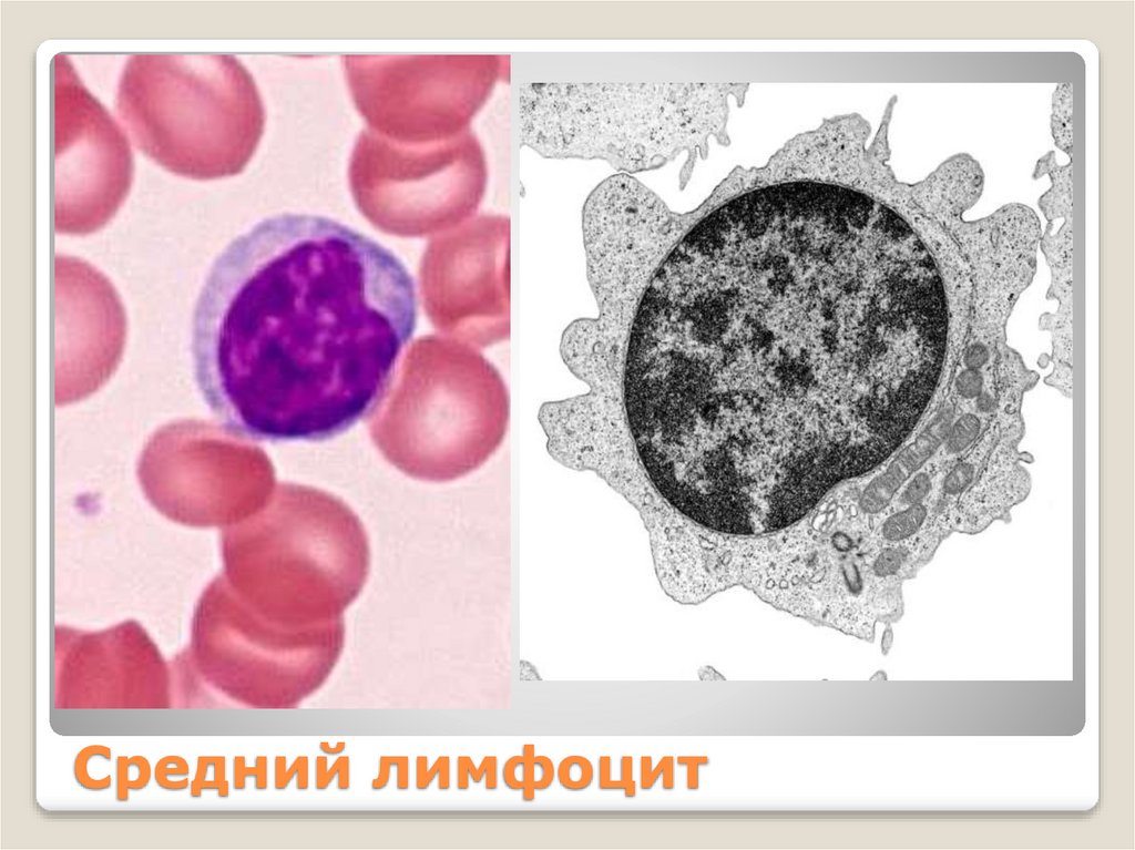 Средний лимфоцит