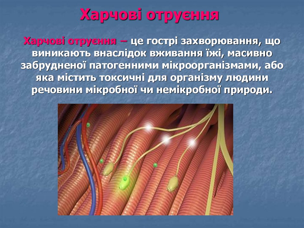 Харчові отруєння