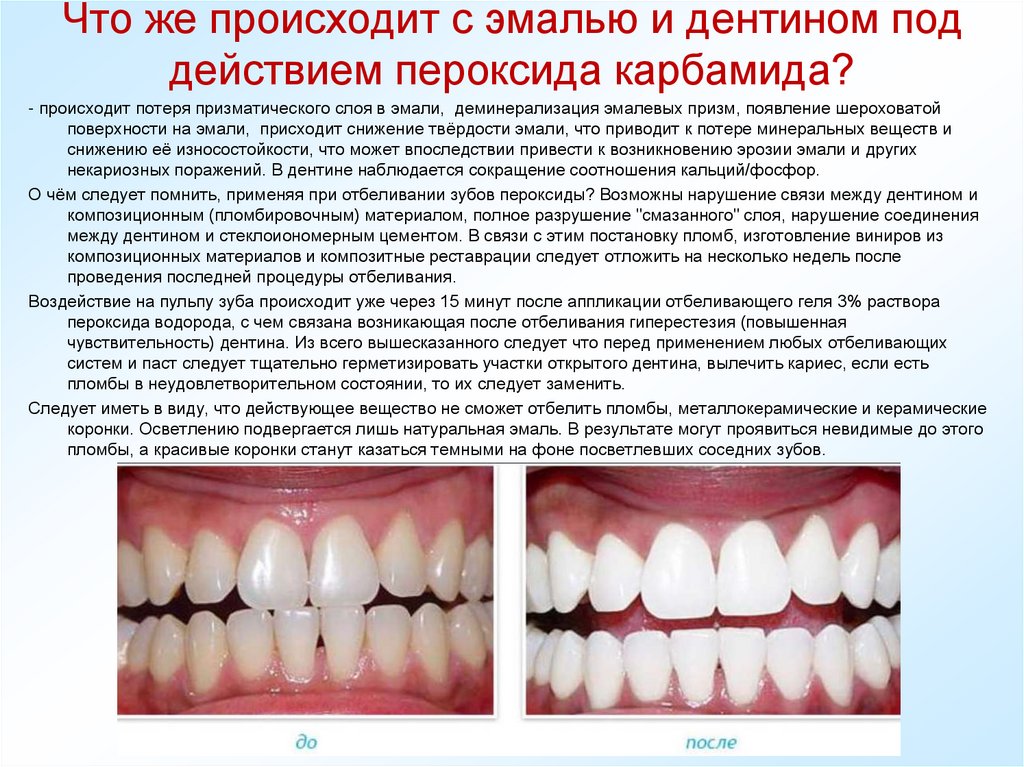 Что же происходит с эмалью и дентином под действием пероксида карбамида?