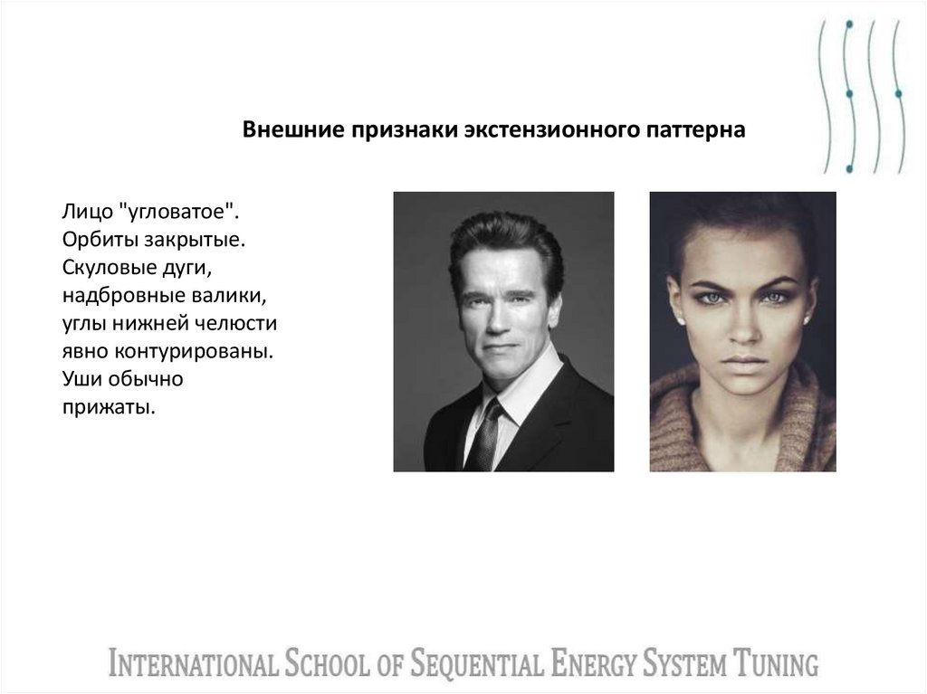 Внешние признаки экстензионного паттерна